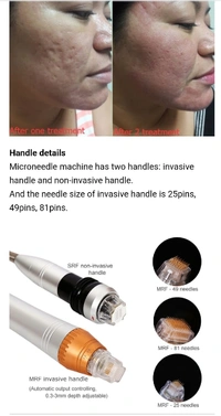 Nubway Laser Machine